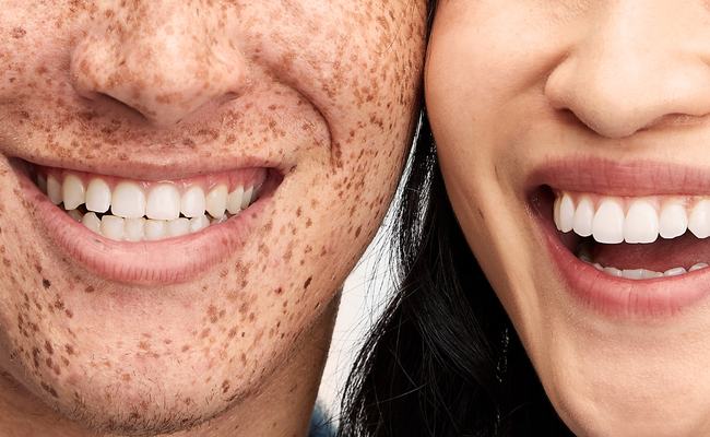 Two patients smiling side by side, showing bright white teeth, after treatment at Breeze Dental