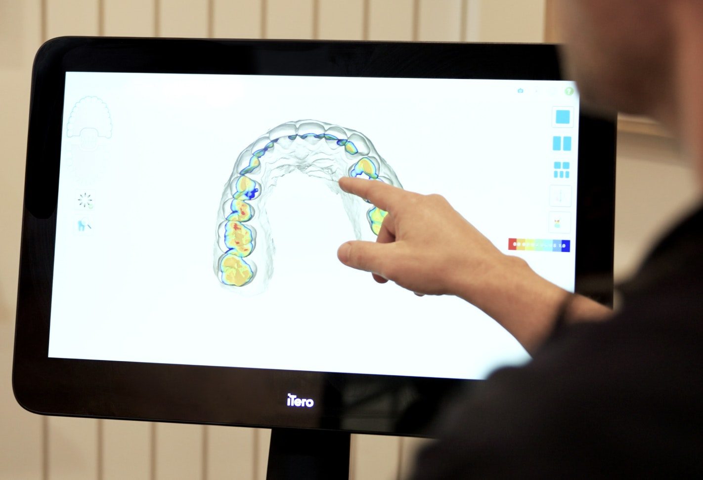 Scanner at Best Austin Dental Practice